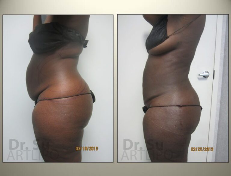 patient photo