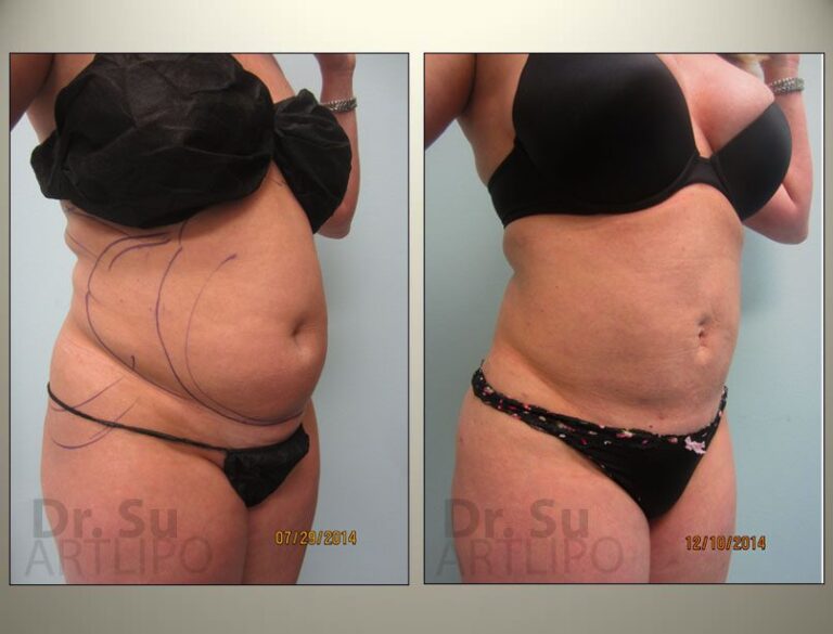 patient photo