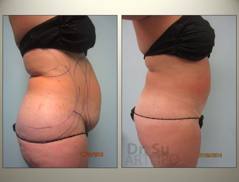 patient photo