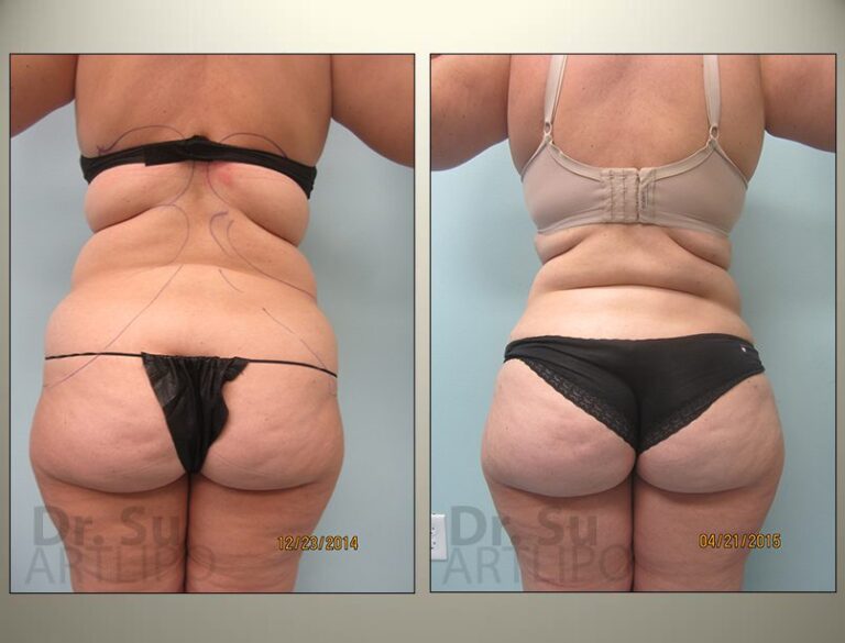 patient photo