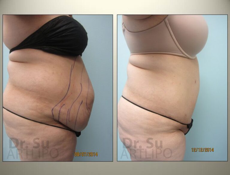 patient photo