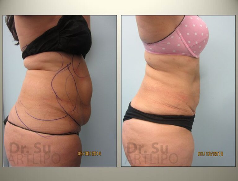 patient photo