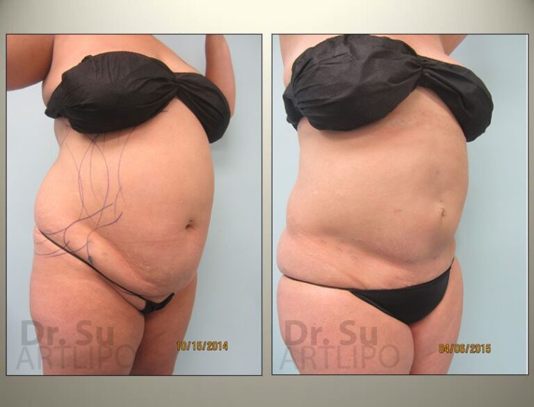 patient photo