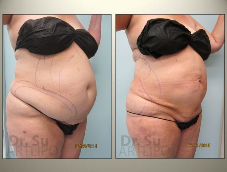 patient photo