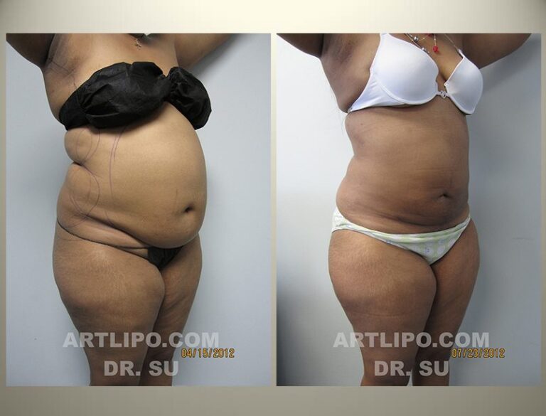 patient photo