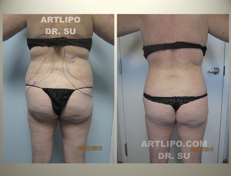 patient photo