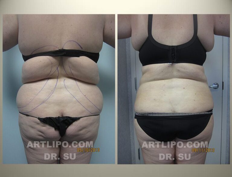 patient photo