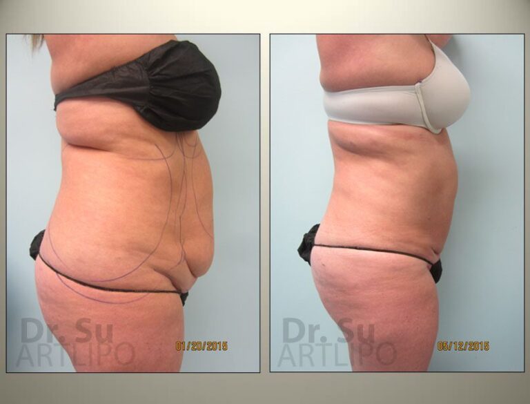 patient photo