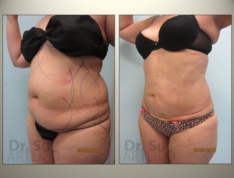 patient photo