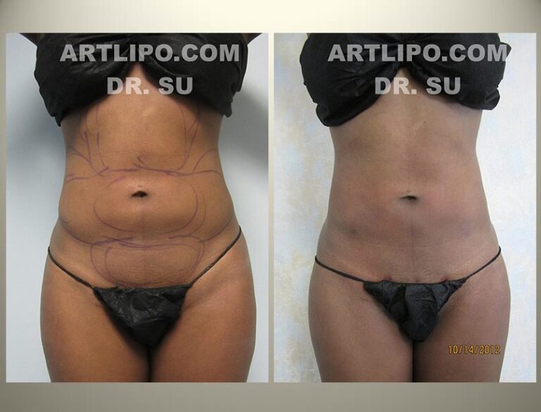 patient photo