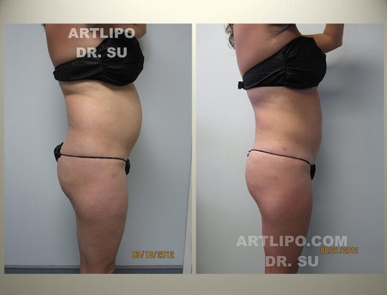 patient photo