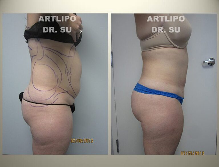 patient photo
