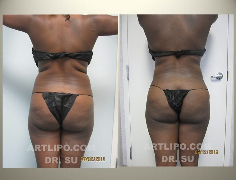 patient photo