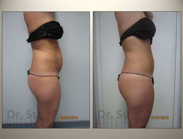 patient photo