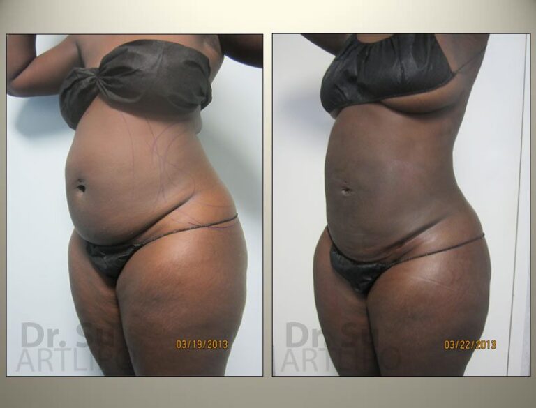 patient photo