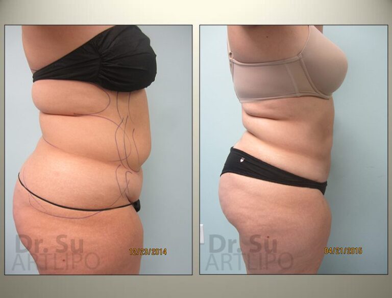 patient photo
