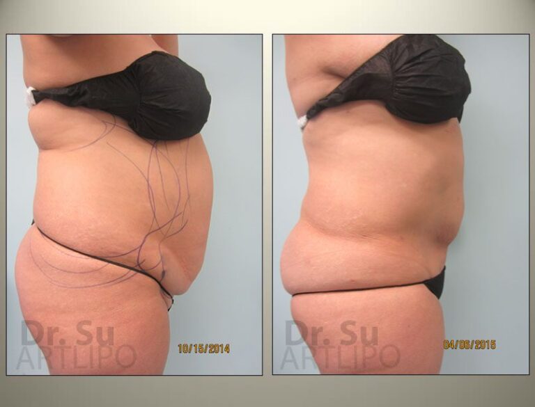 patient photo