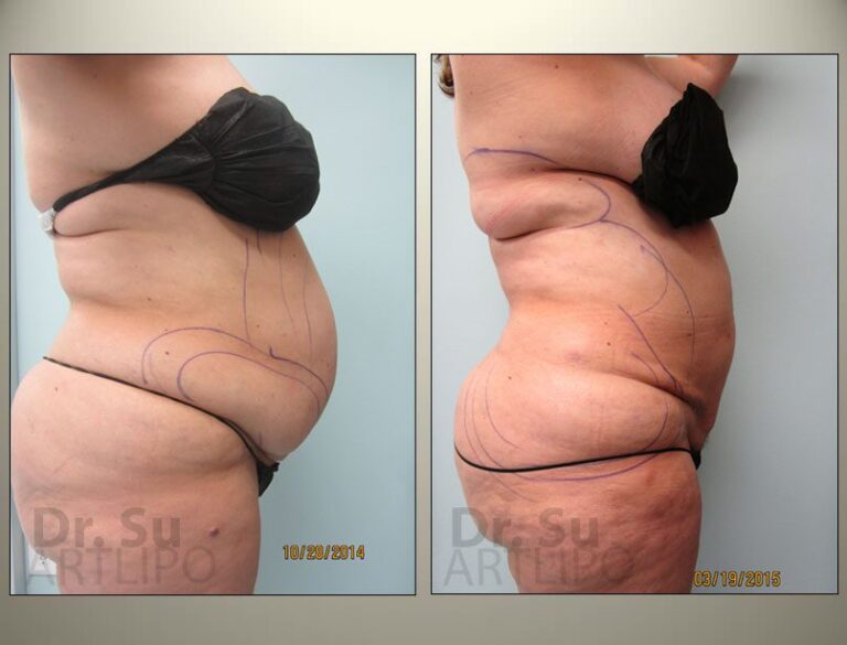 patient photo