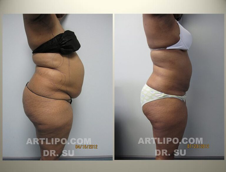 patient photo