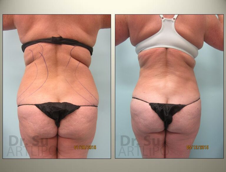 patient photo