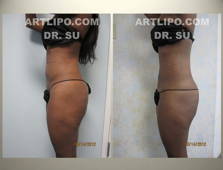 patient photo
