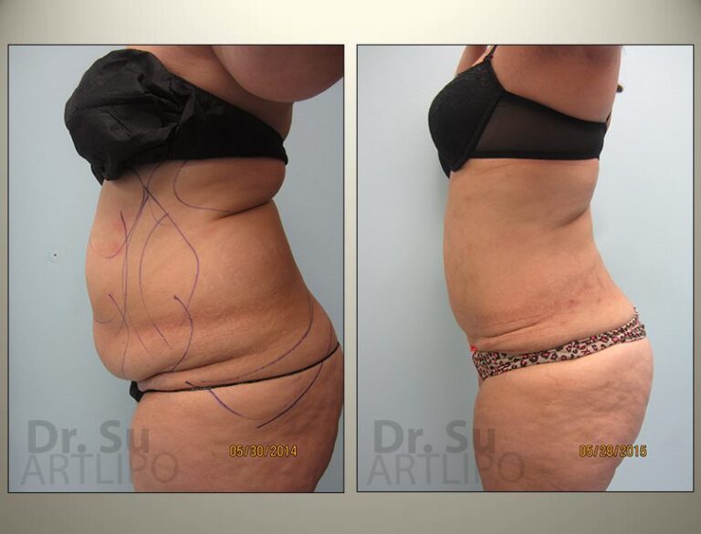 patient photo