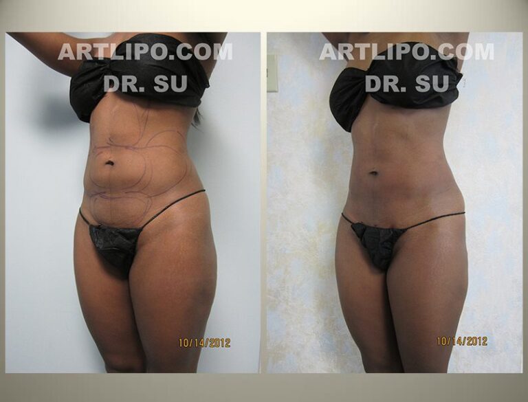 patient photo