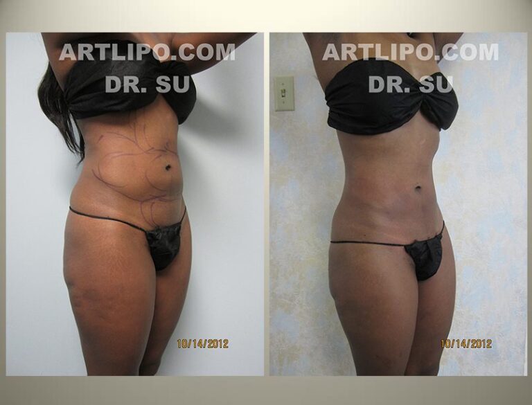 patient photo