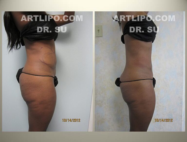 patient photo