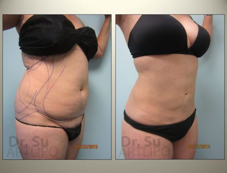 patient photo