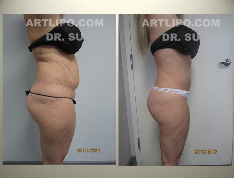 patient photo