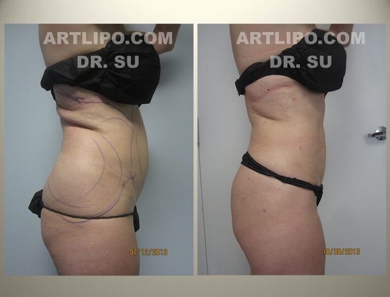 patient photo