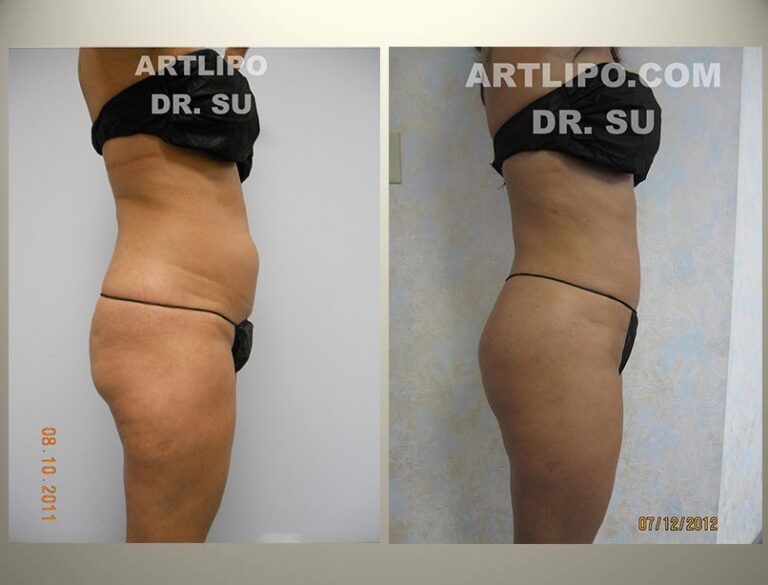 patient photo