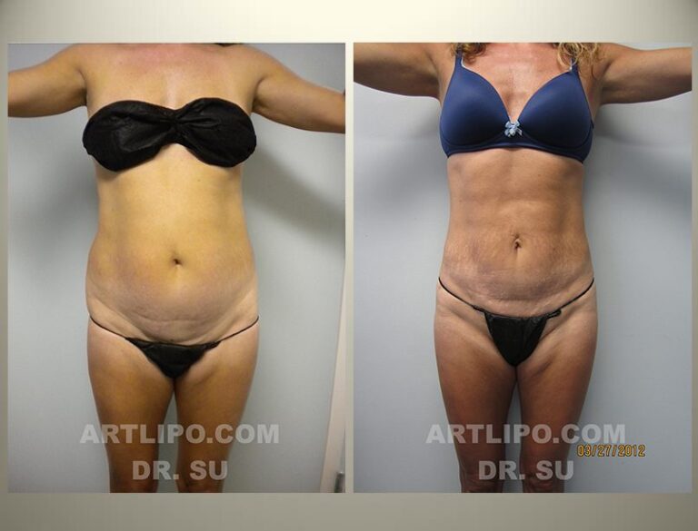 patient photo