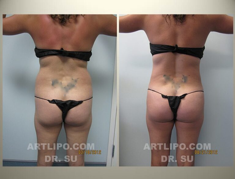 patient photo