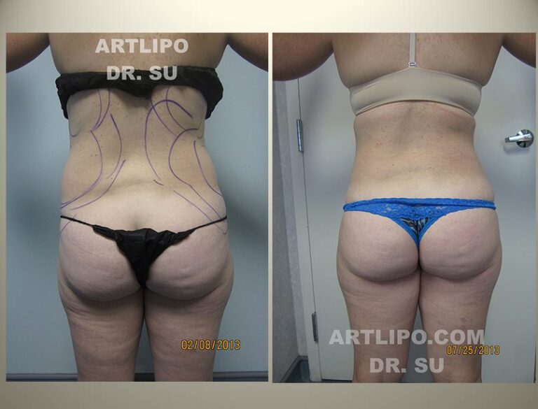 patient photo