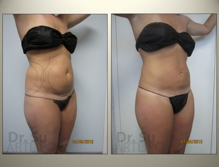 patient photo