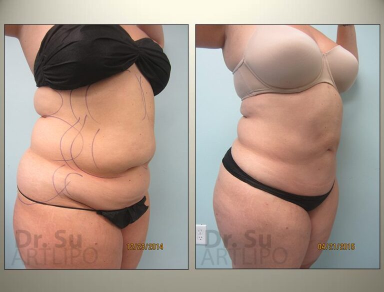 patient photo