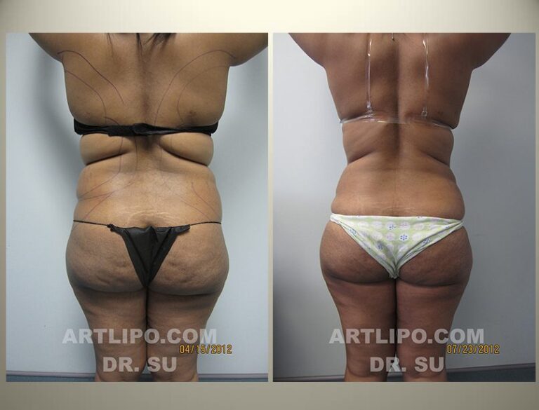 patient photo