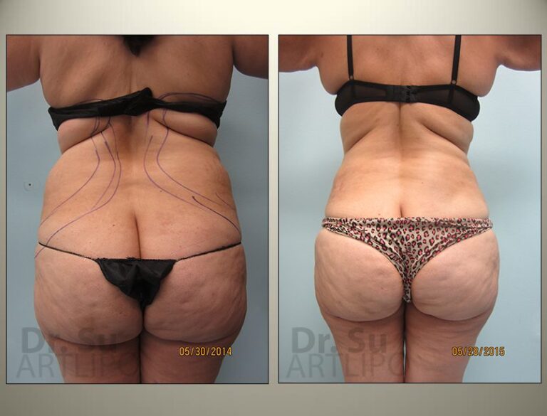 patient photo
