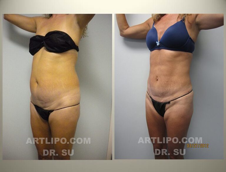 patient photo