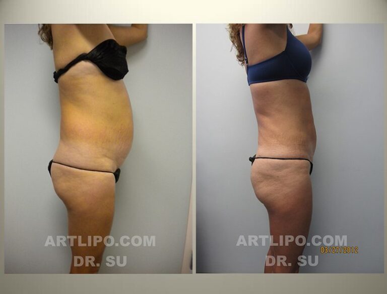 patient photo