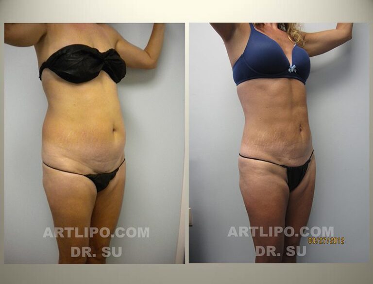 patient photo