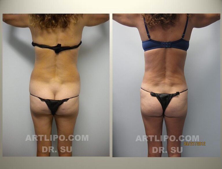 patient photo
