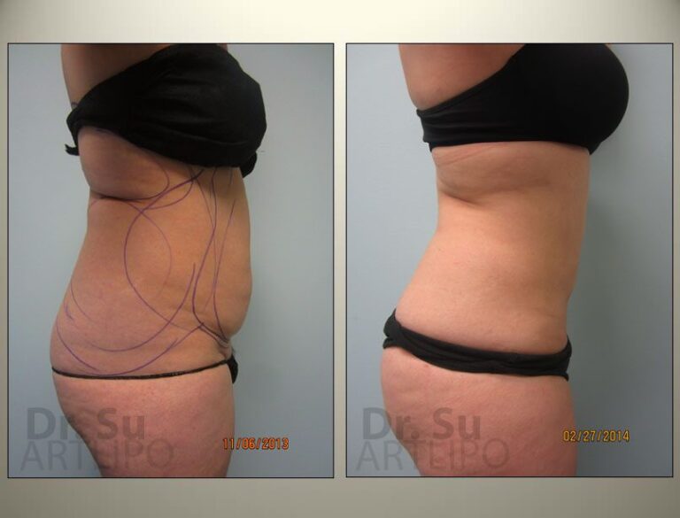 patient photo