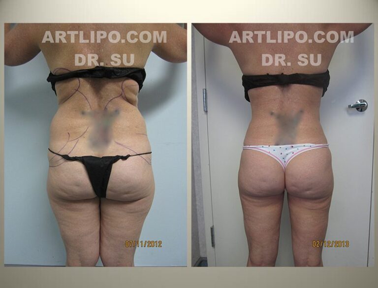 patient photo