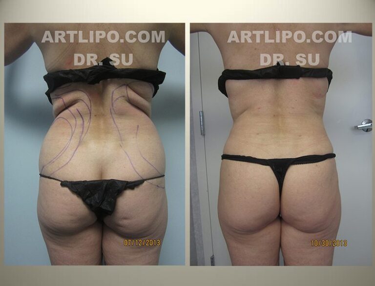 patient photo