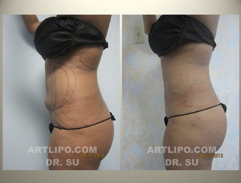 patient photo
