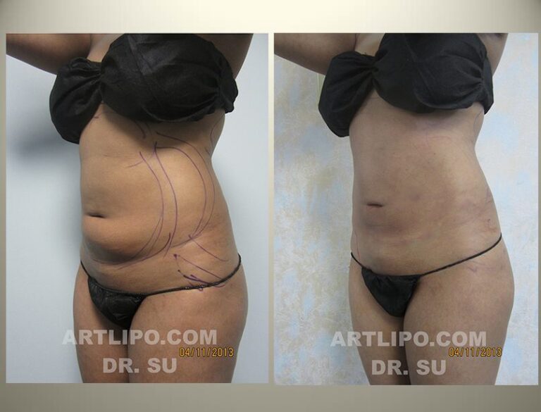 patient photo