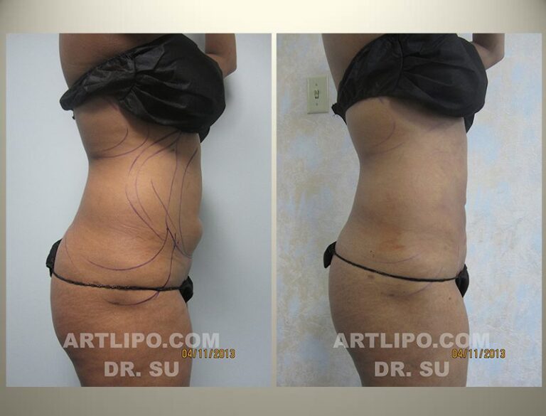 patient photo